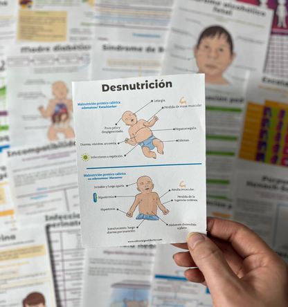 Pediatría en flashcards PDF