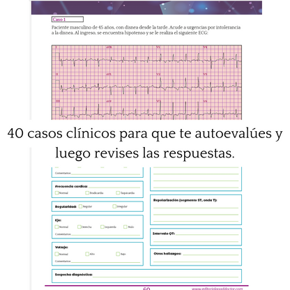 Libro en PDF: Manual de electrocardiograma (versión para imprimir)